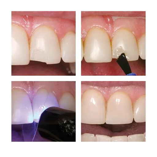 Add&Bond Adhesive Composite Primer